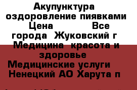 Акупунктура, оздоровление пиявками › Цена ­ 3 000 - Все города, Жуковский г. Медицина, красота и здоровье » Медицинские услуги   . Ненецкий АО,Харута п.